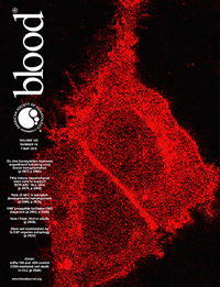 Science Journal: Blood - The American Society of Hematology